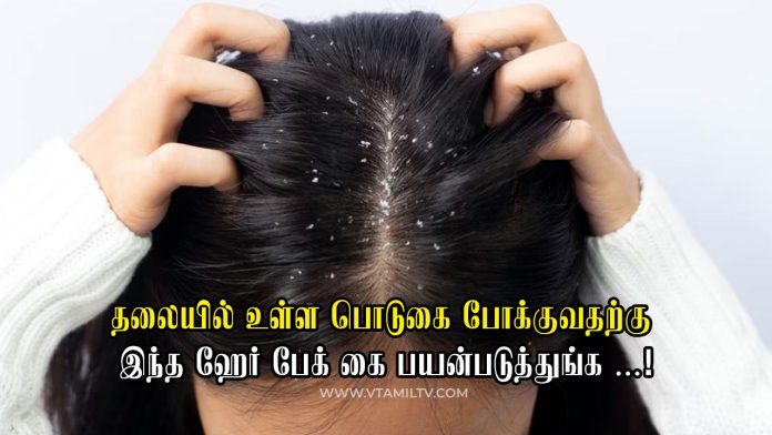 dandruff